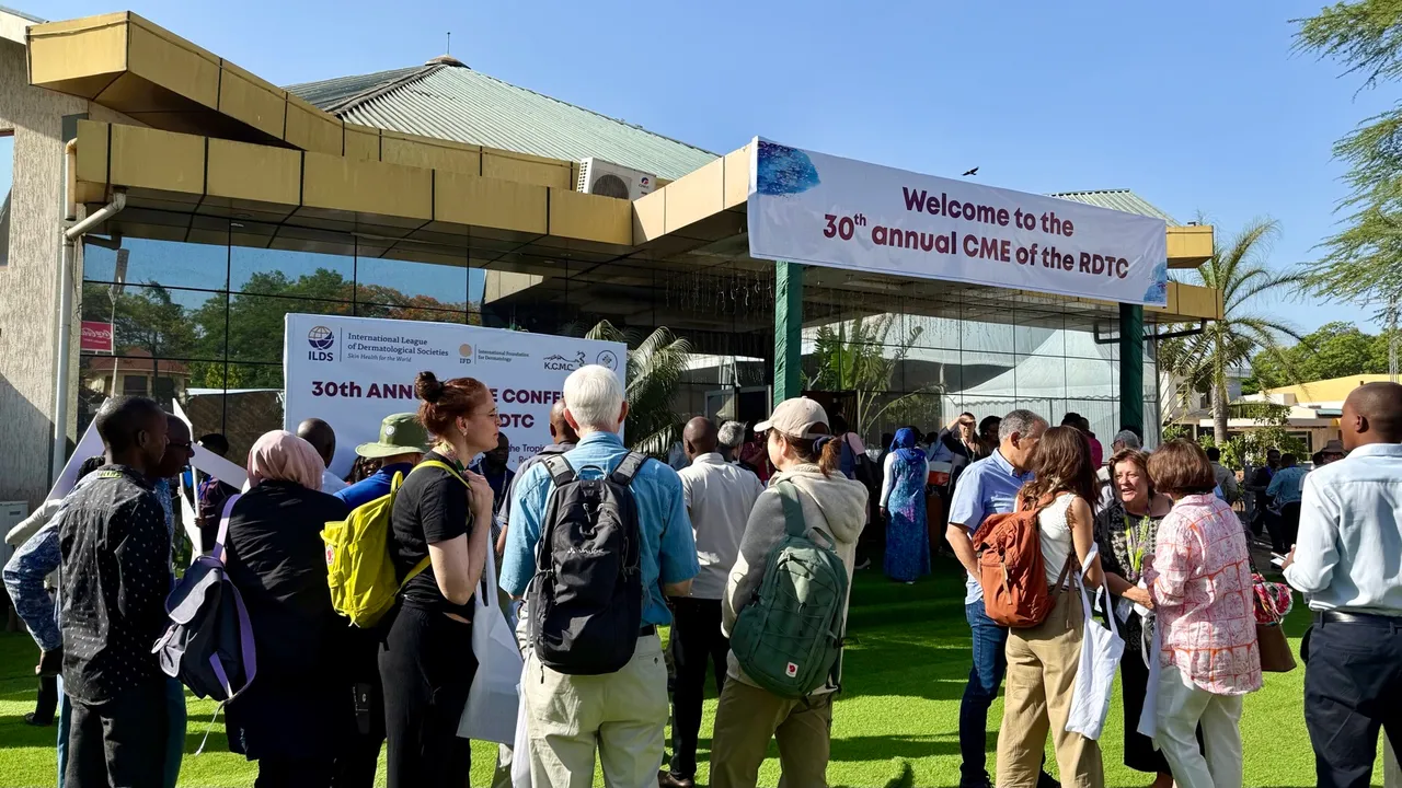 Recepción frente al edificio de la conferencia bajo la pancarta “Welcome to the 30th annual CME of the RDTC” en Moshi